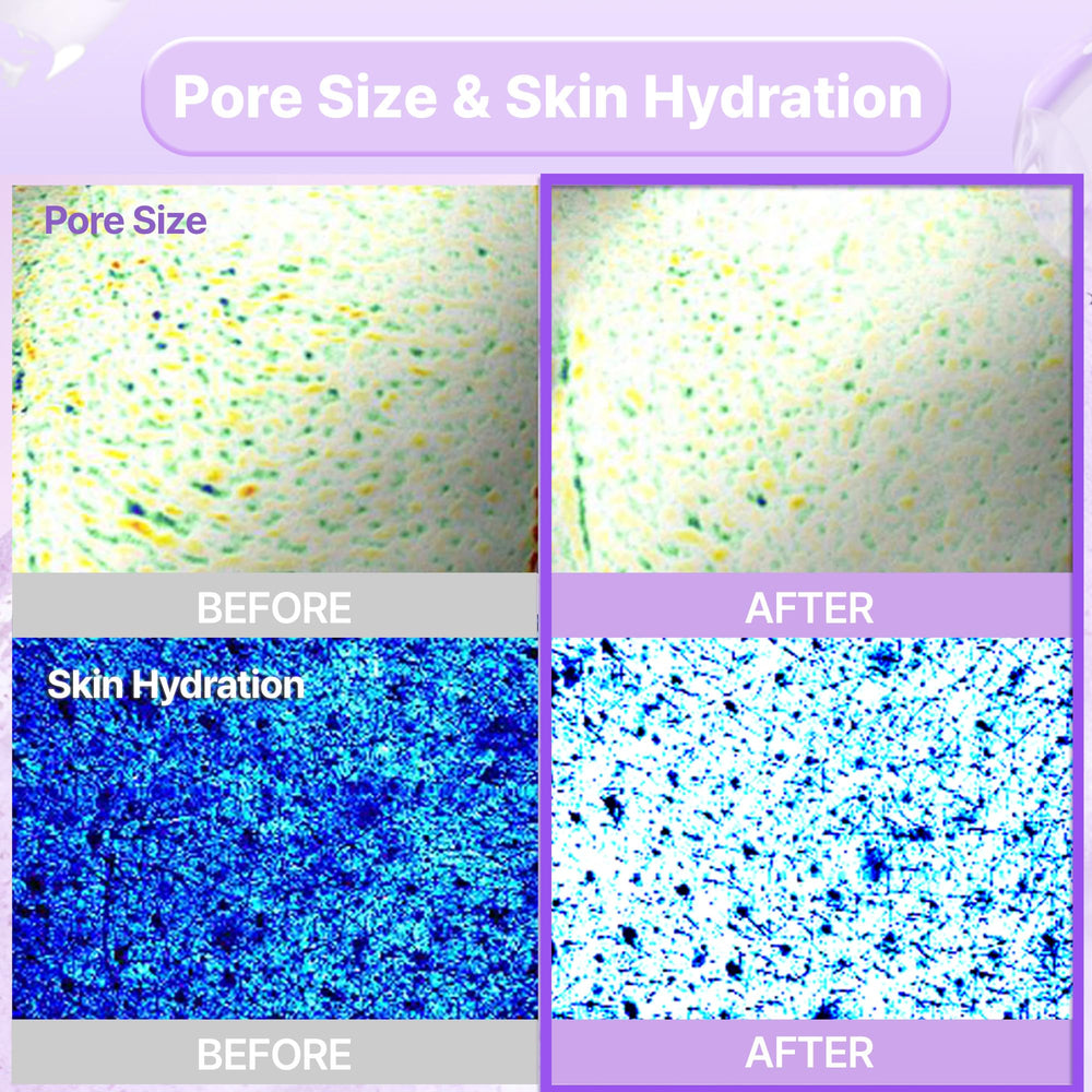 BIOHEAL BOH PROBIODERM firming and moisturizing action depicted by smooth, plump skin effect.