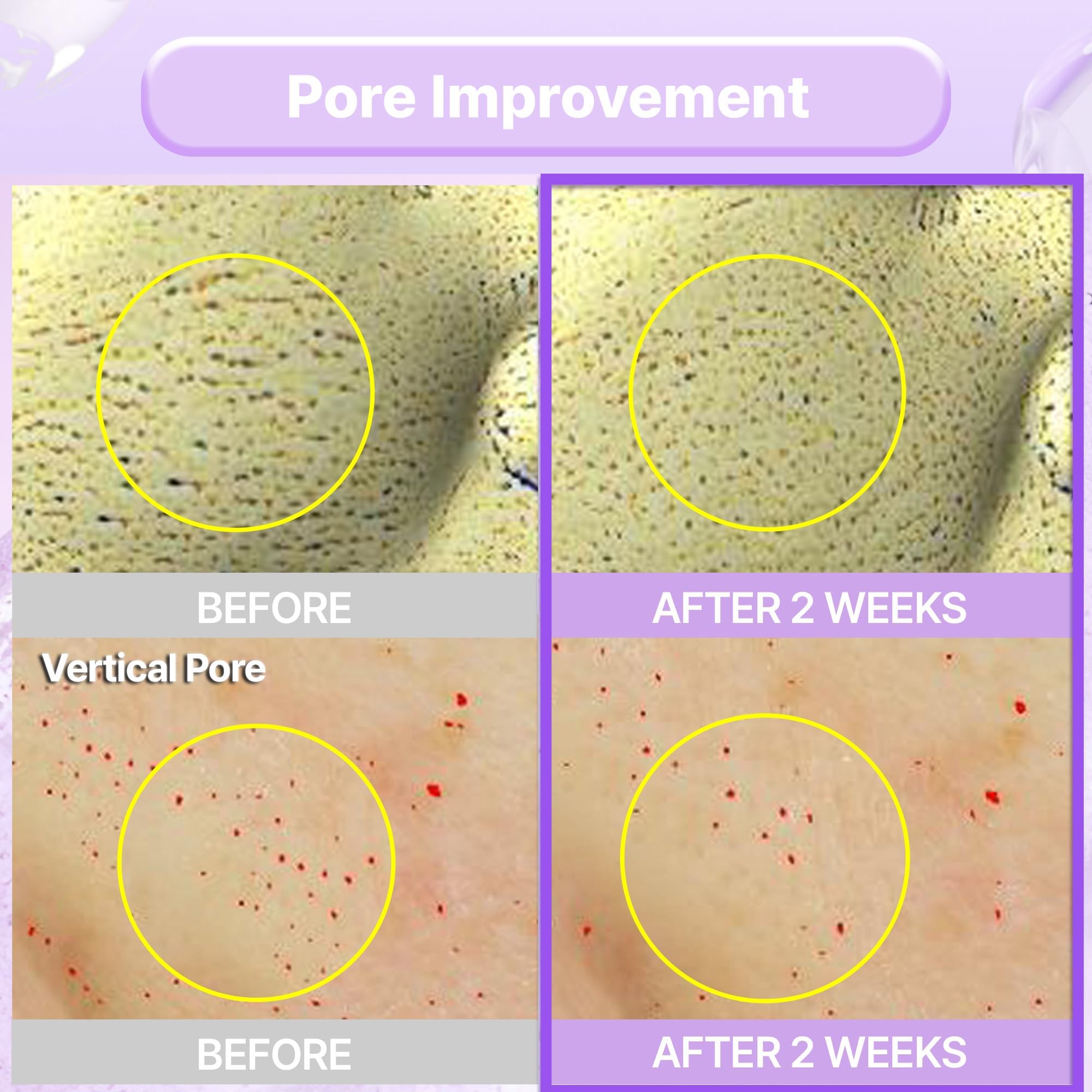 BIOHEAL BOH Probioderm hydration-glow shot emphasizing daily moisturization