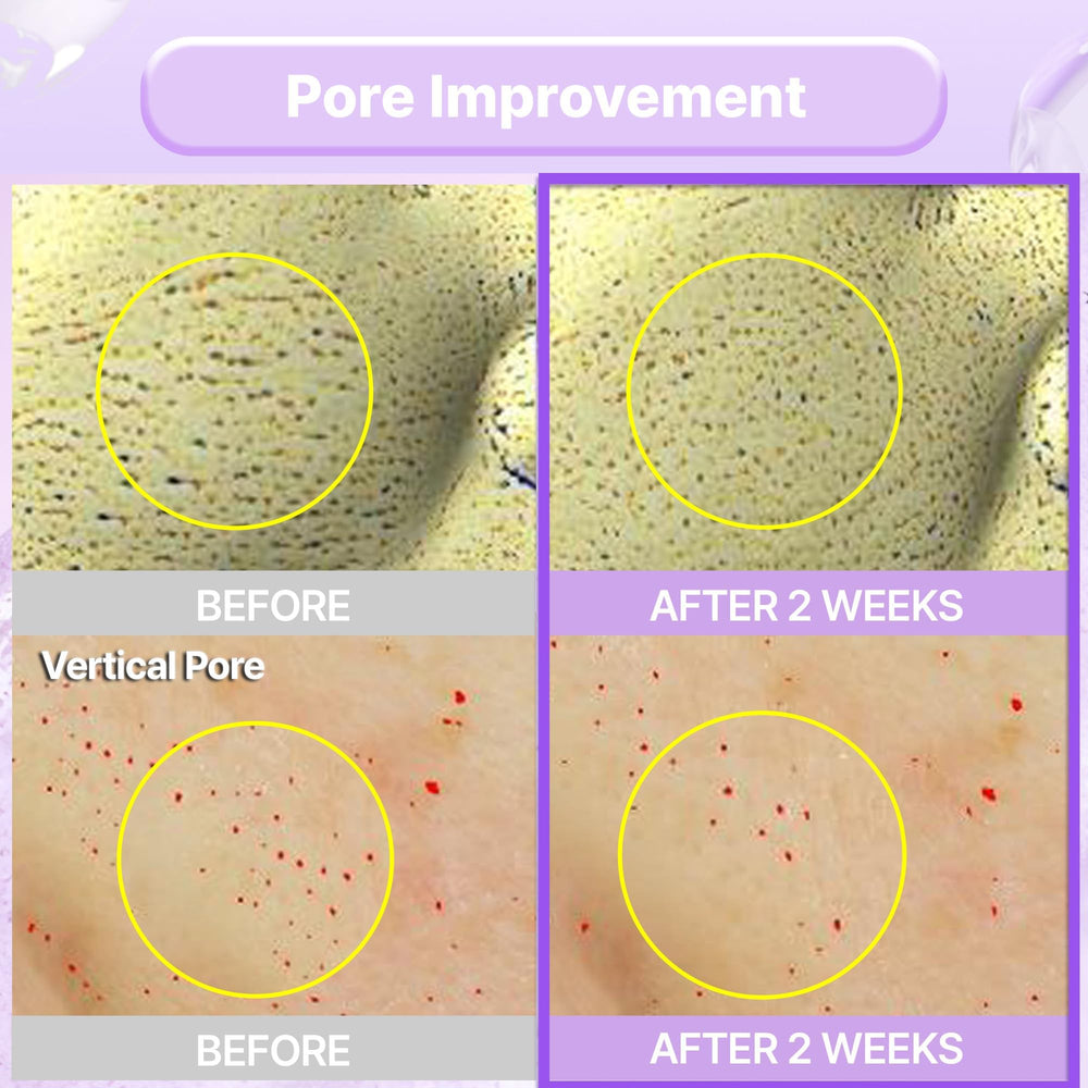 BIOHEAL BOH Probioderm hydration-glow shot emphasizing daily moisturization