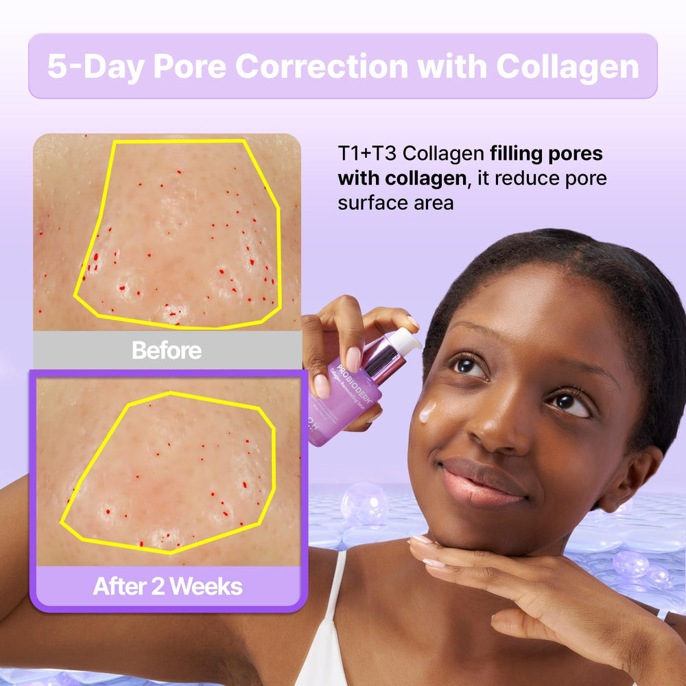 BIOHEAL BOH Probioderm pores-closeup demonstrating refined skin texture
