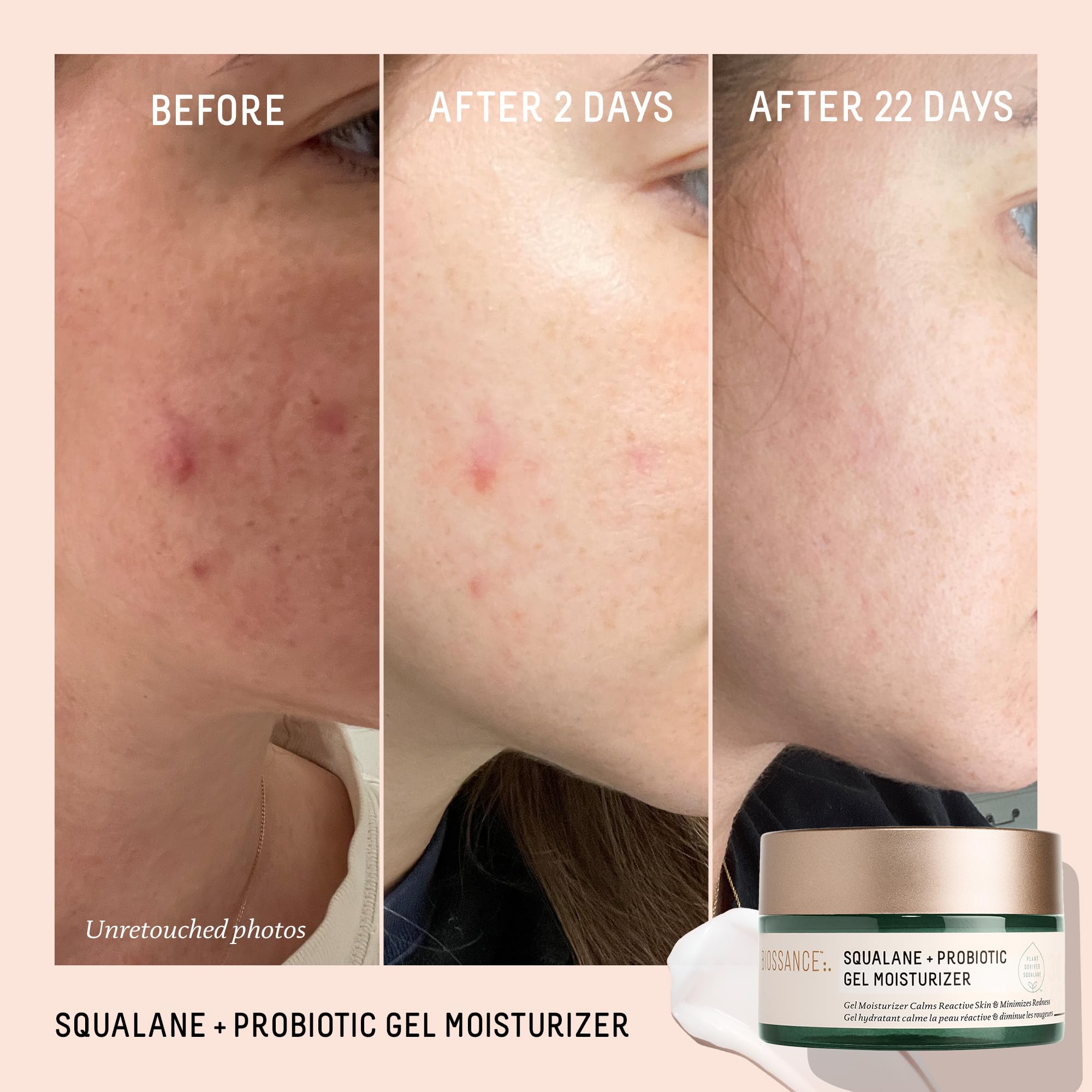 Close-up of encapsulated probiotics technology in Biossance moisturizer highlights potent active delivery.