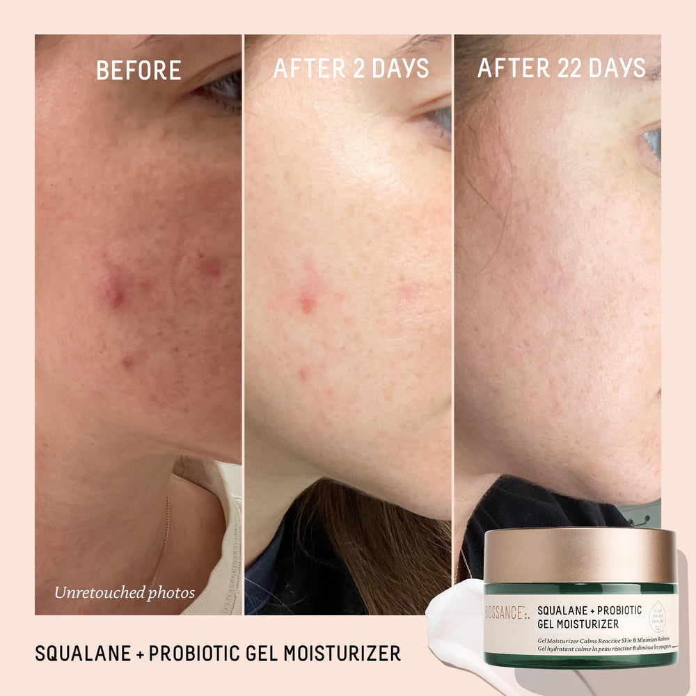Close-up of encapsulated probiotics technology in Biossance moisturizer highlights potent active delivery.