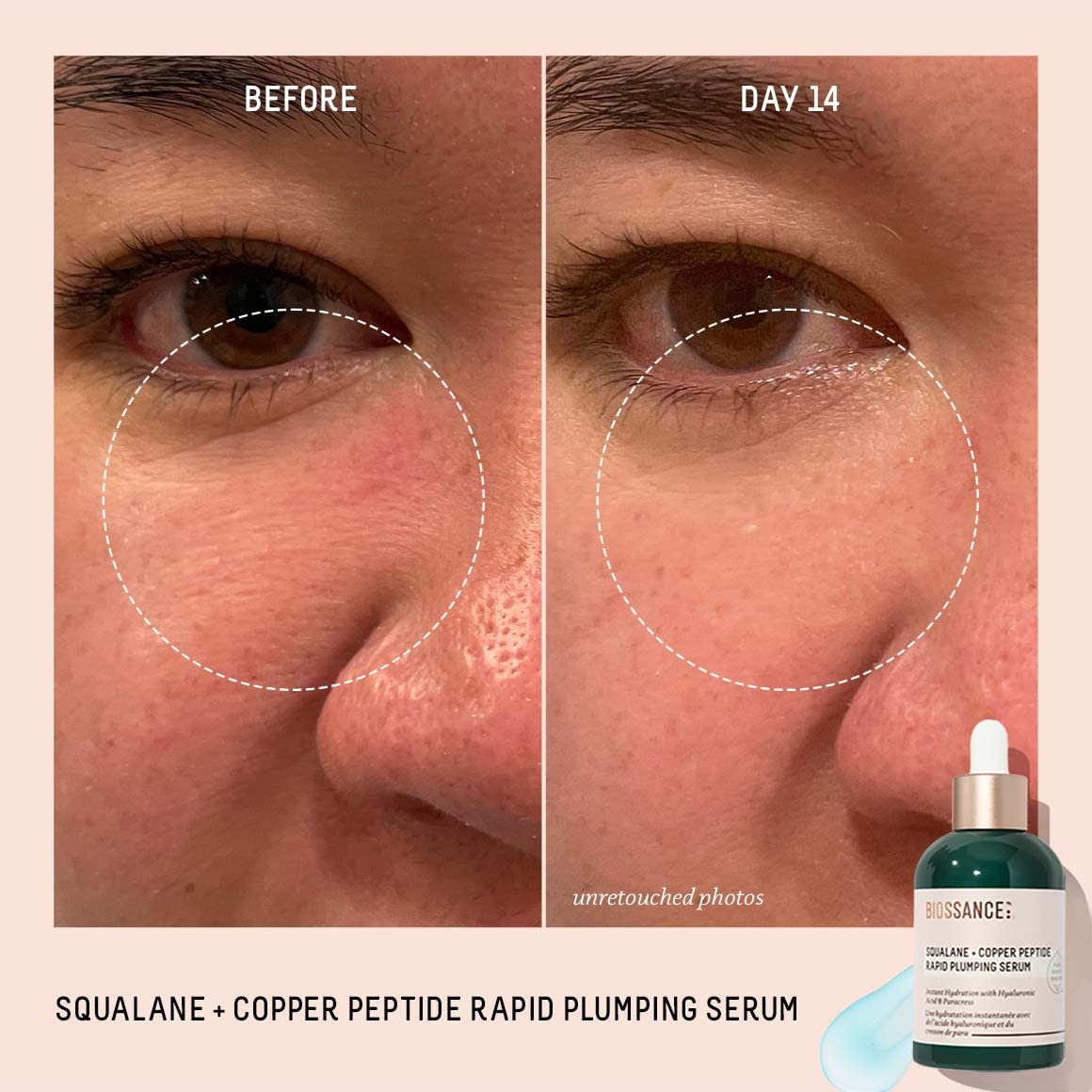 Hyaluronic acid droplet highlighting deep hydration and smoothing effect.