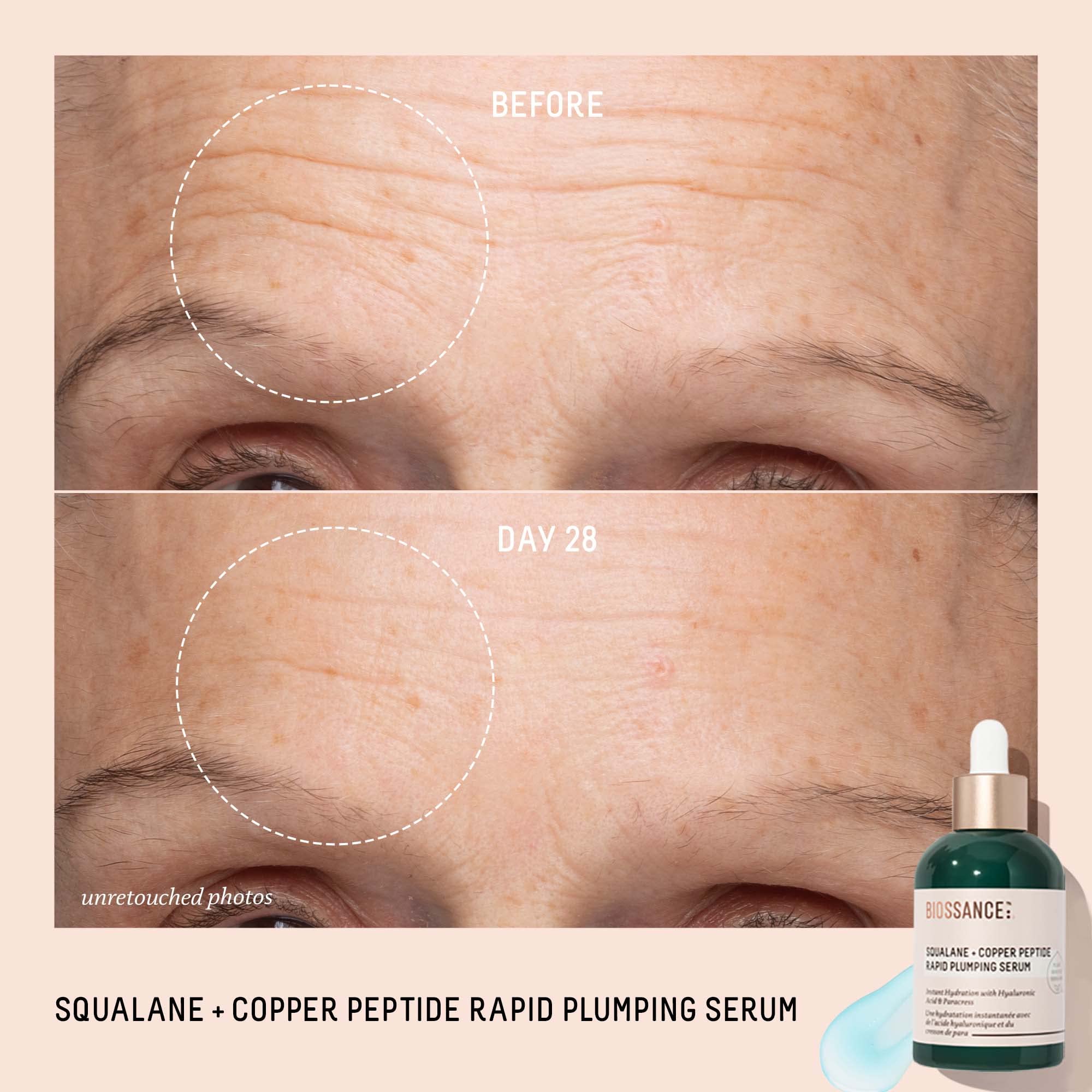 Paracress extract instantly lifts and refines skin texture on contact.