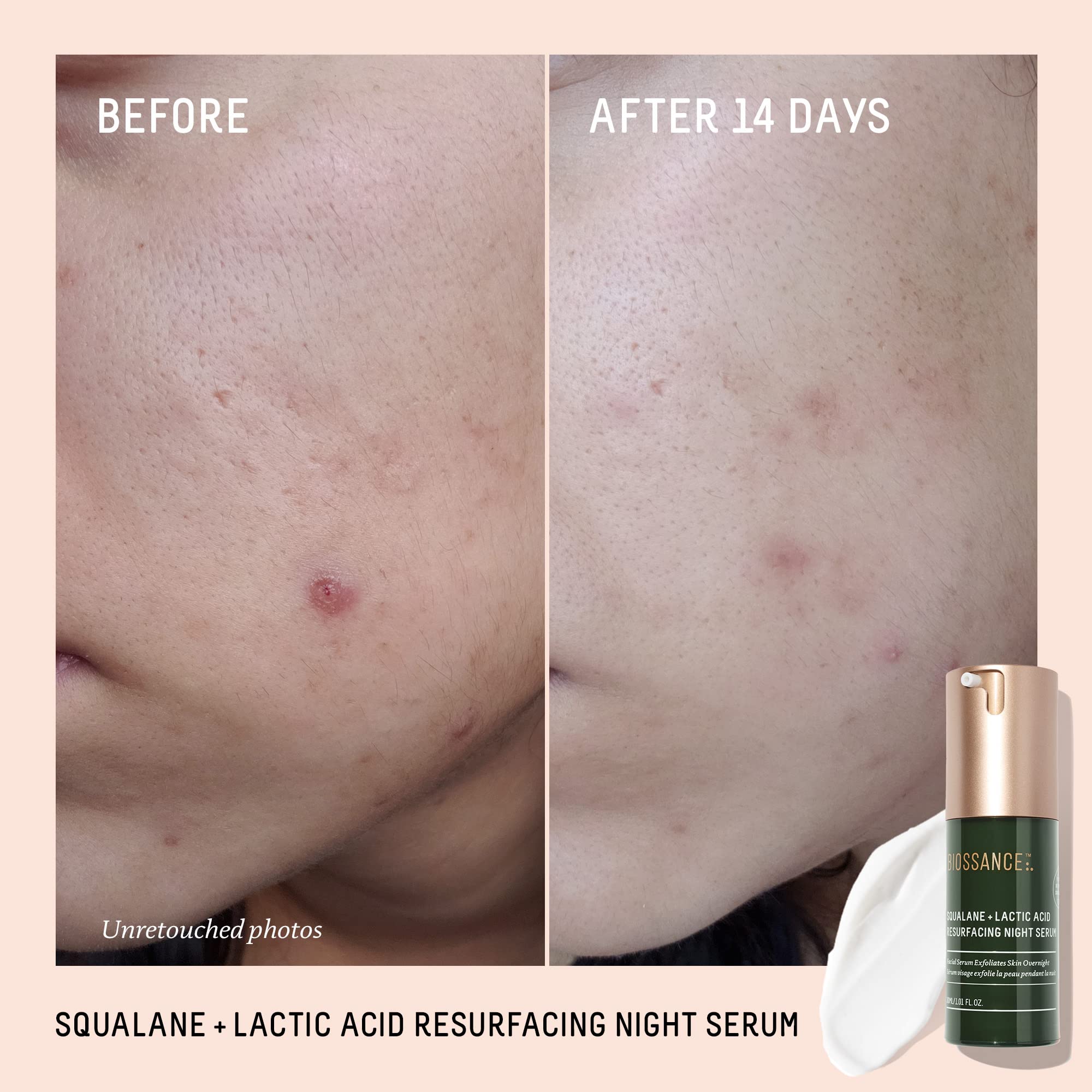 BIOSSANCE Rapid Radiance Set serum application demonstrates quick-absorbing, non-greasy finish