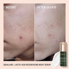 BIOSSANCE Rapid Radiance Set serum application demonstrates quick-absorbing, non-greasy finish