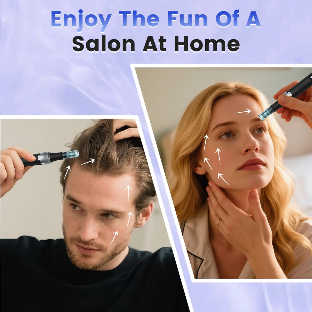 Bird Here Derma Roller used on hair for scalp refresh and care.