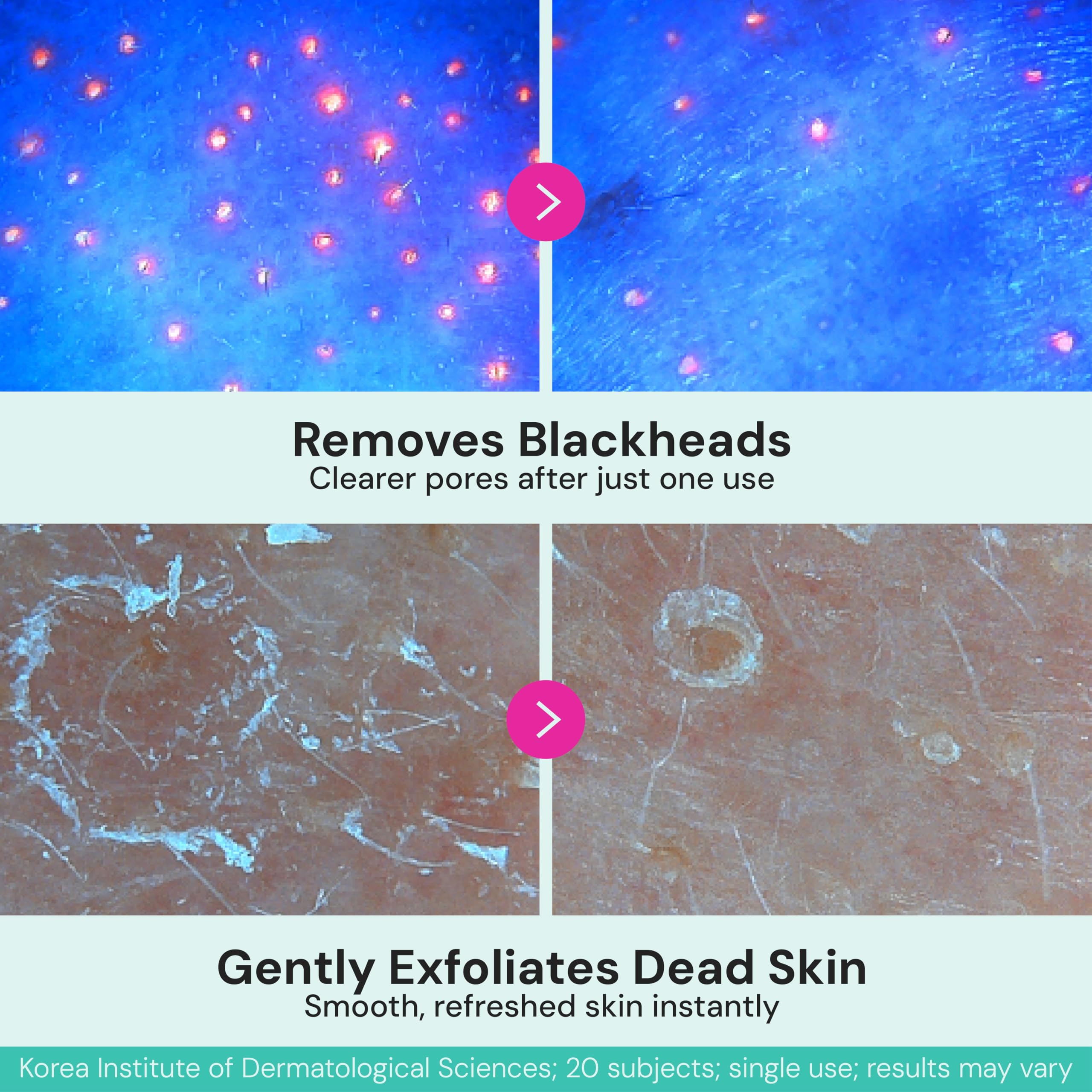 BIVID In & Out close-fit bio-cellulose mask covers nose and chin for even delivery.