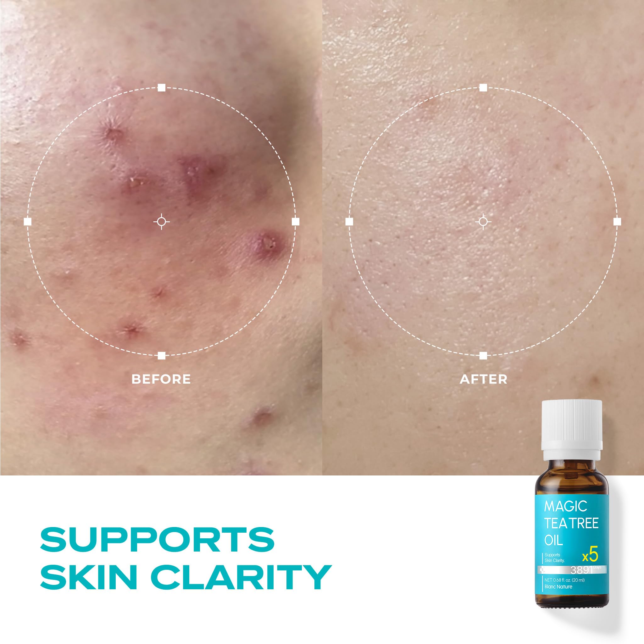 BLANC NATURE Magic Tea Tree Oil close-up on skin during routine.