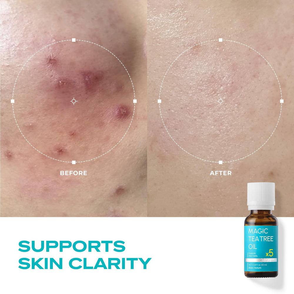 BLANC NATURE Magic Tea Tree Oil close-up on skin during routine.