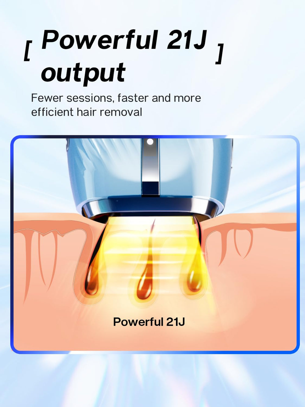 Blex 21J energy output targets follicles across body areas