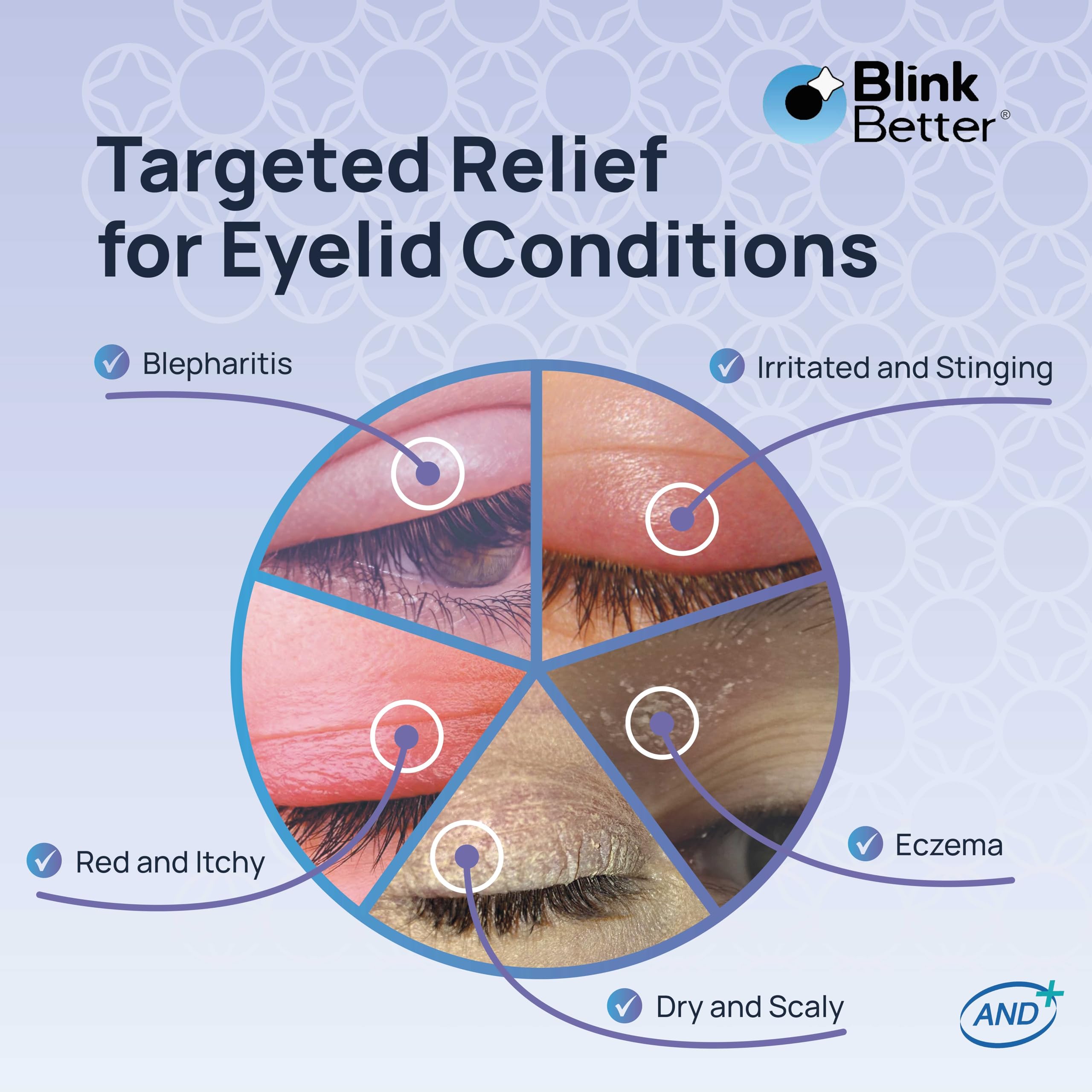 BlinkBetter BetterLids ingredient card highlights oat complex and Panthenol for conditioning.