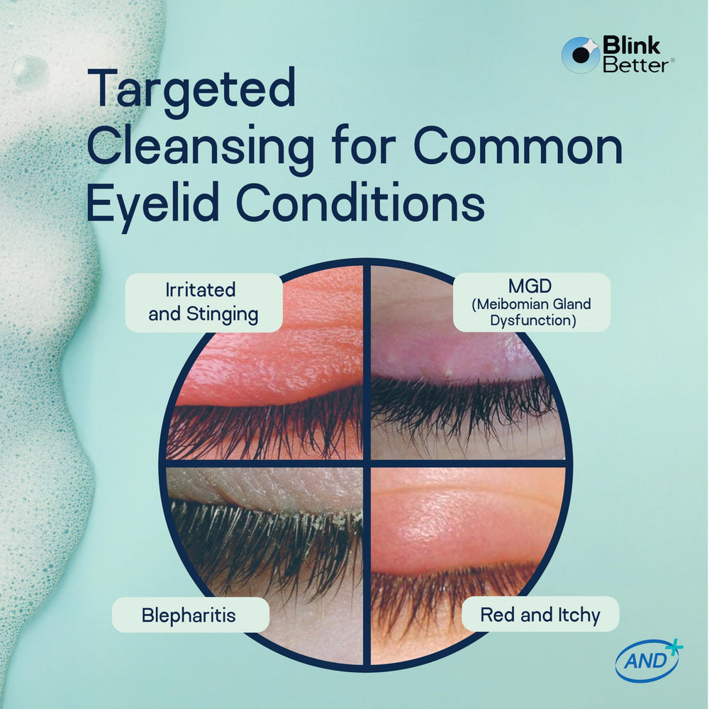 BlinkBetter BetterLids packaging box front reveals 4-in-1 formula.