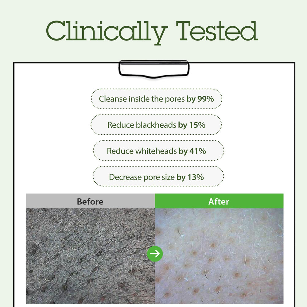 BLITHE cleansing balm may reduce oil and leave residue-free, refined skin.