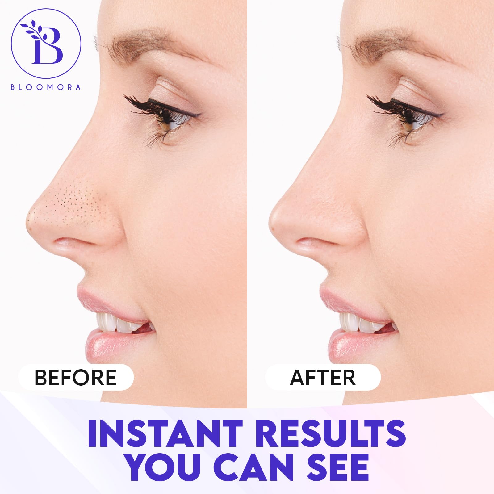 BLOOMORA Nose Strip with witch hazel infusion suggesting pore tightening.