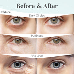 BLOOMORA Eye Patches packaging with travel-friendly design