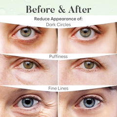 BLOOMORA under-eye patches close-up showing moisturizing hyaluronic acid action