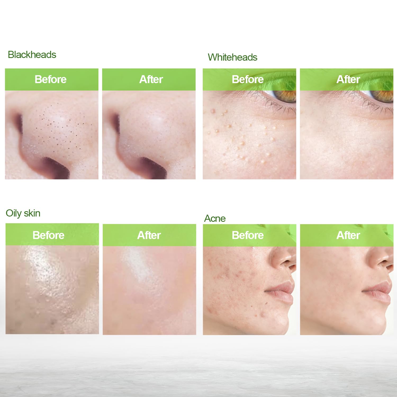 Blooskim Blackhead Remover Mask in drying stage demonstrates peel-off action.