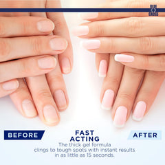 Blue Cross cuticle remover liquid gel dissolving hangnails in seconds closeup.
