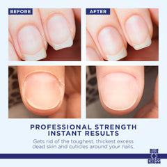 Hands with smooth cuticles after use illustrating salon-like results and comfortable maintenance.