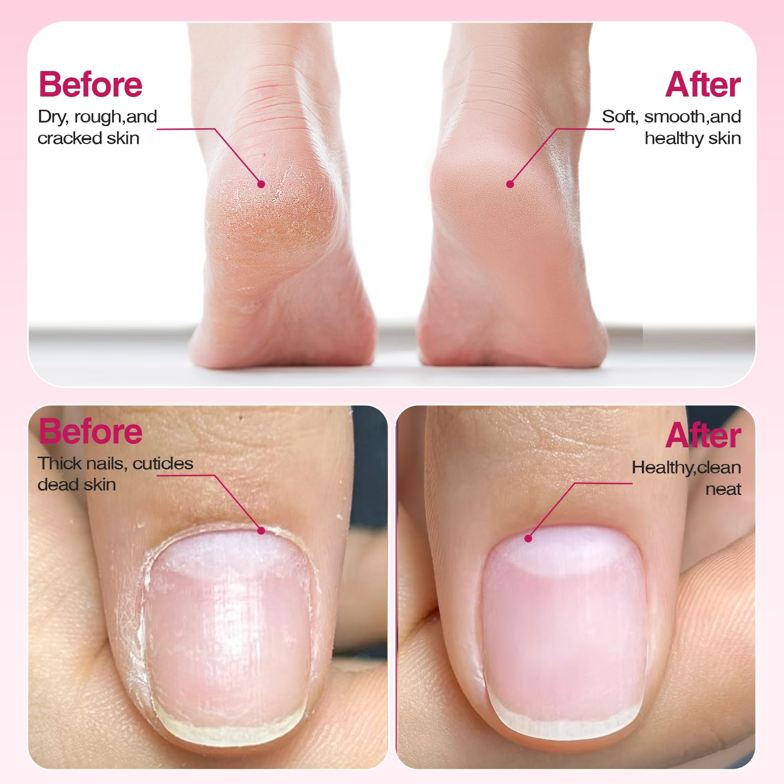 Blue Sea Sky 20 sanding belts for thick nails and callus care.