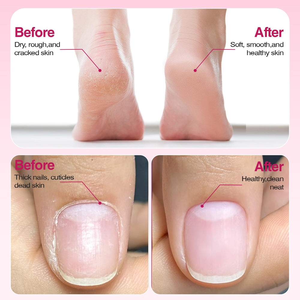 Blue Sea Sky 20 sanding belts for thick nails and callus care.