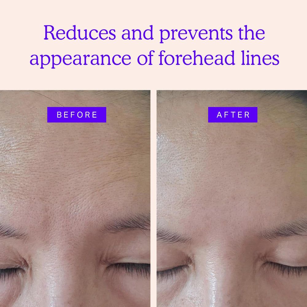 BLUMBODY face patches application closeup—easy-to-apply, skin-friendly design
