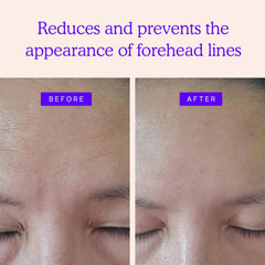 BLUMBODY face patches application closeup—easy-to-apply, skin-friendly design