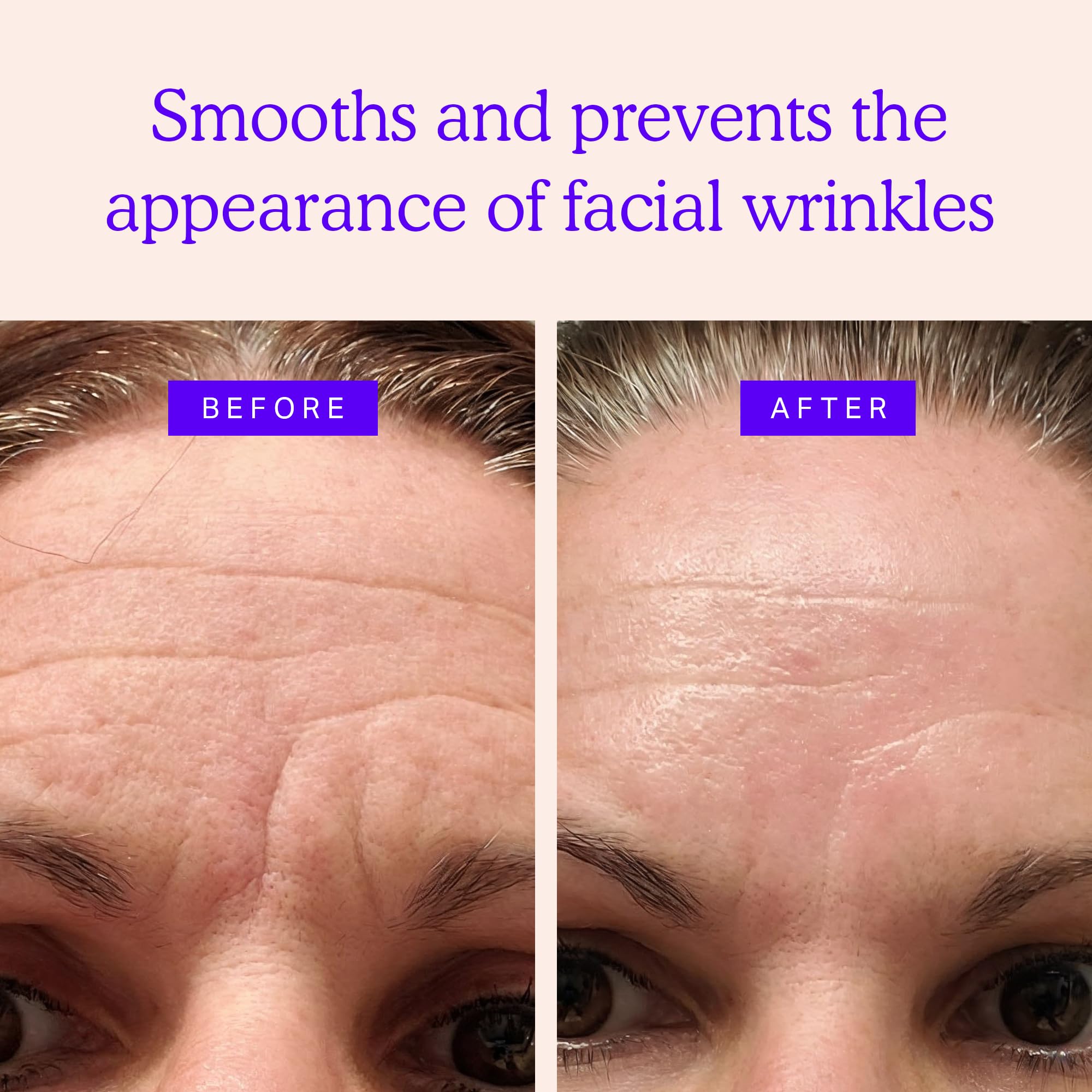 BLUMBODY face patches triangle eye area for crow's feet visibility reduction.