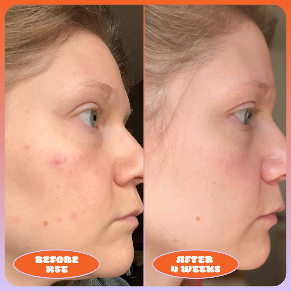 Hydration emphasis with Hyaluronic Acid in Milky Fade for plump skin.