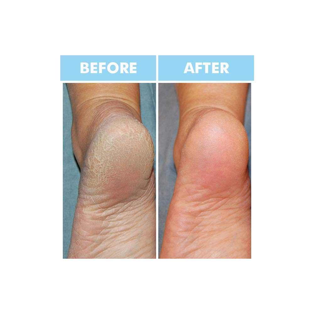 Bodipure At-home spa demonstrates easy-use hands and feet treatment.