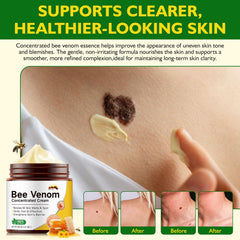 BOIUOITI Bee Venom Cream with botanicals nourishes and balances skin.
