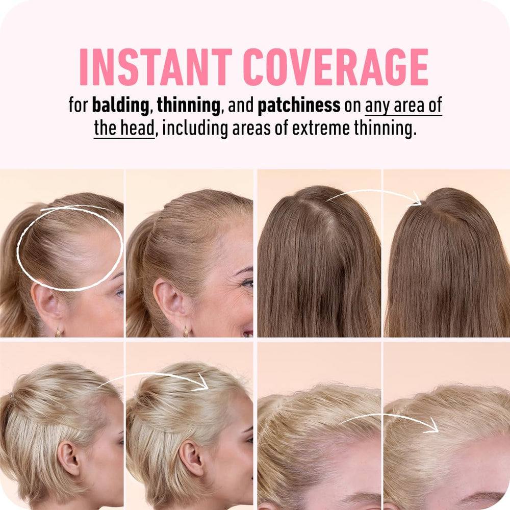 Boldify Hairline Powder on the scalp creates an undetectable hairline color