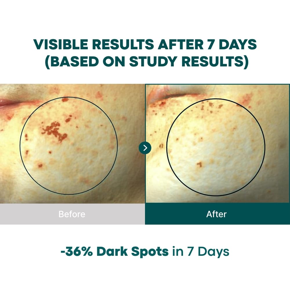 BONCEPT Vita C bottle label close-up communicates dermatologist-tested, sensitive-skin-friendly formula.