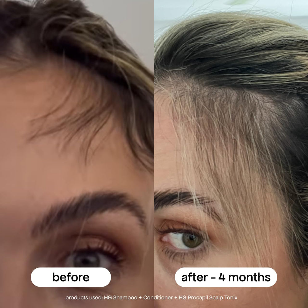 Bondiboost HG bottle designed for all hair types in daily routines.