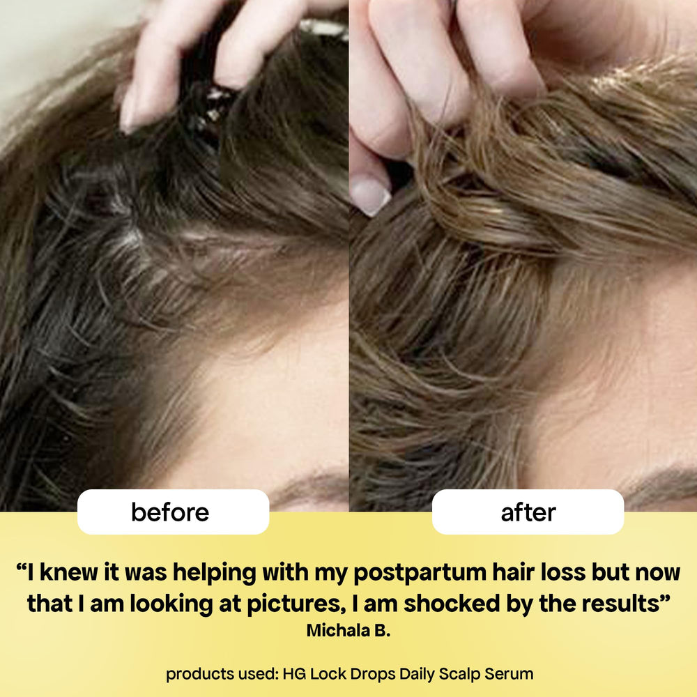 BondiBoost HG Lock Drops daily-use serum enhances scalp health and density over time.
