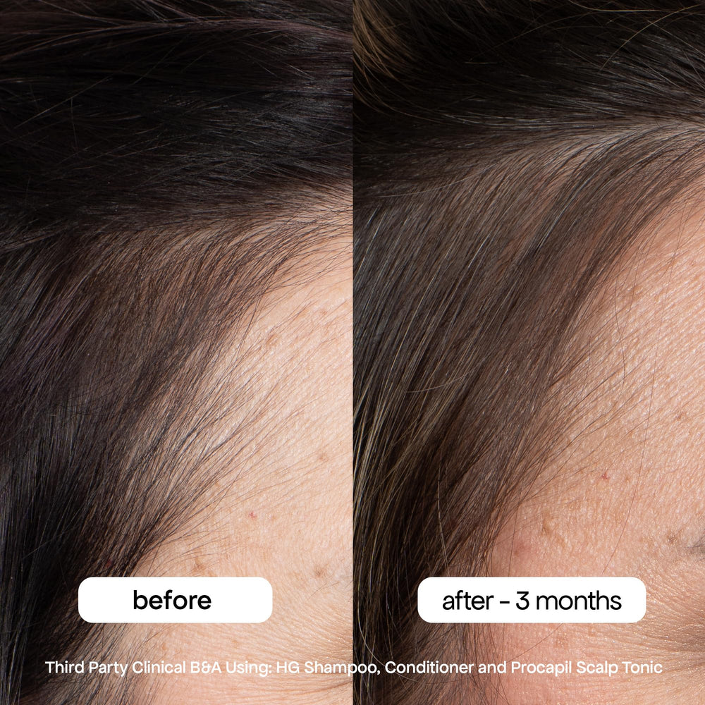 BondiBoost HG scalp-refresh scene conveys cooling wash experience.