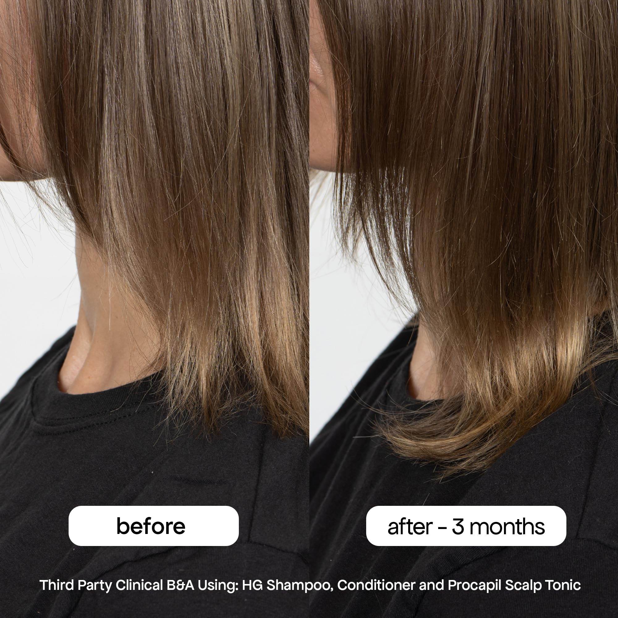 Bondiboost HG clinical results graph indicates potential stronger hair outcomes.