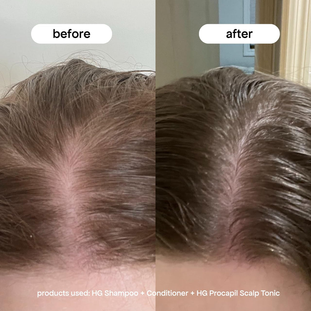 BONDIBOOST Procapil rosemary extract illustration supports scalp circulation.
