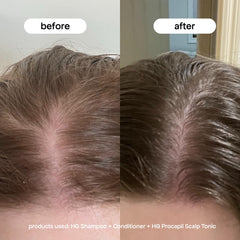 BONDIBOOST Procapil rosemary extract illustration supports scalp circulation.