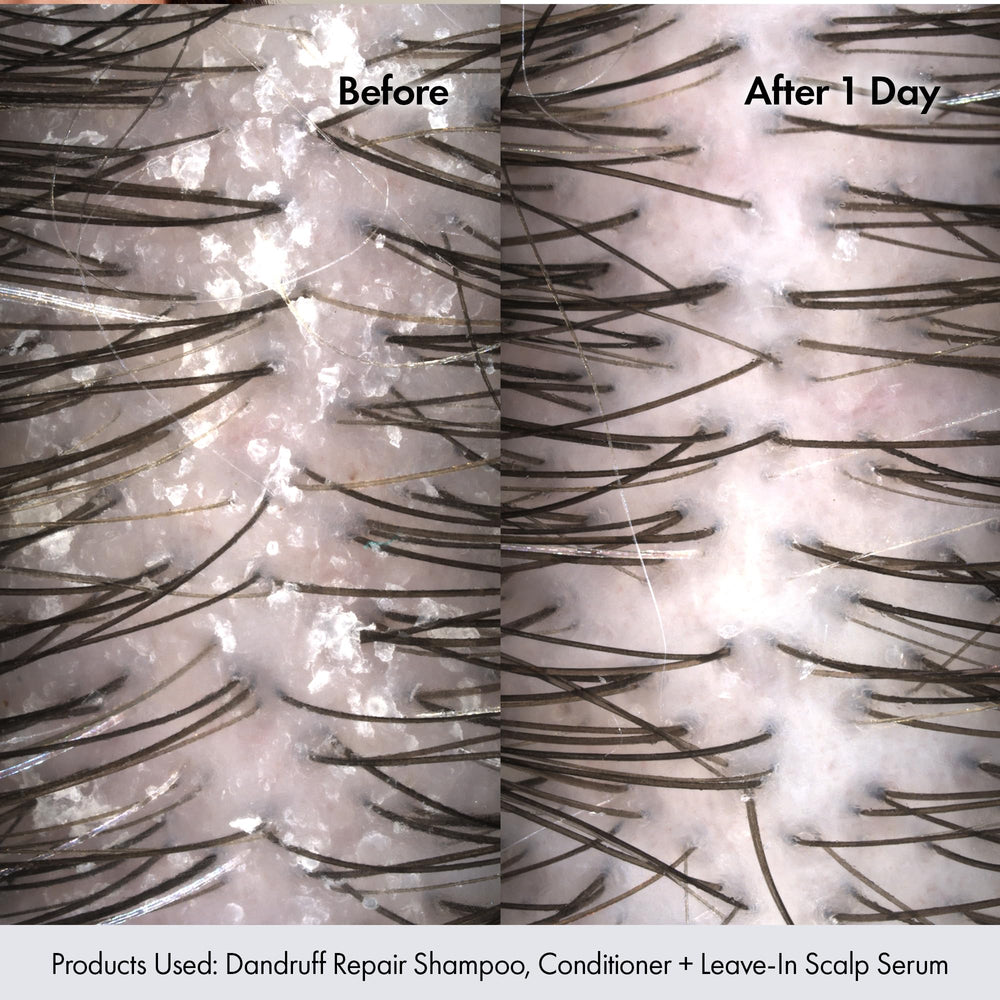 Bondiboost lather shot shows refreshing scent and gentle cleansing for scalp comfort.