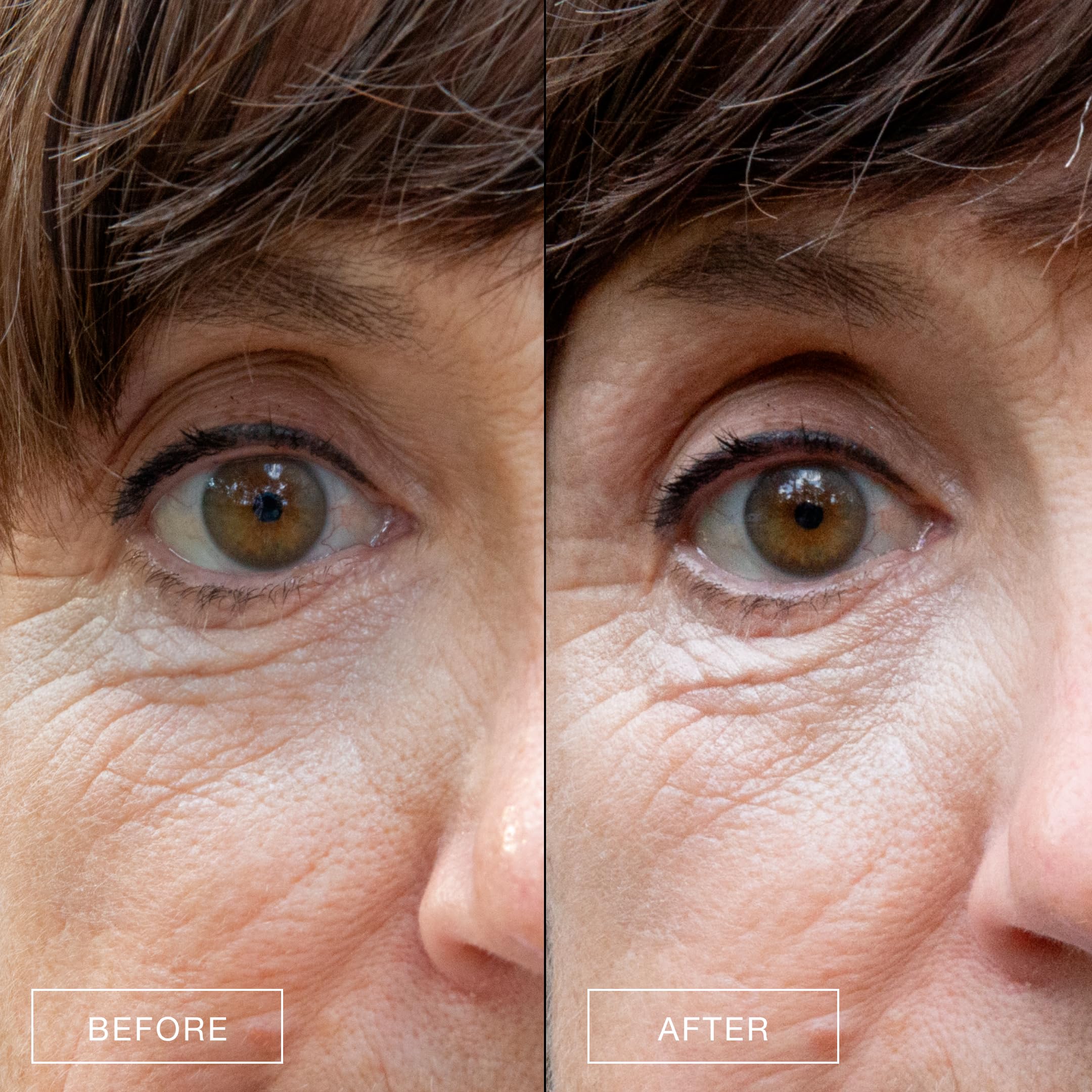 BOOM! by Cindy Joseph under-eye cream being lightly patted around the eye area for nourishment.