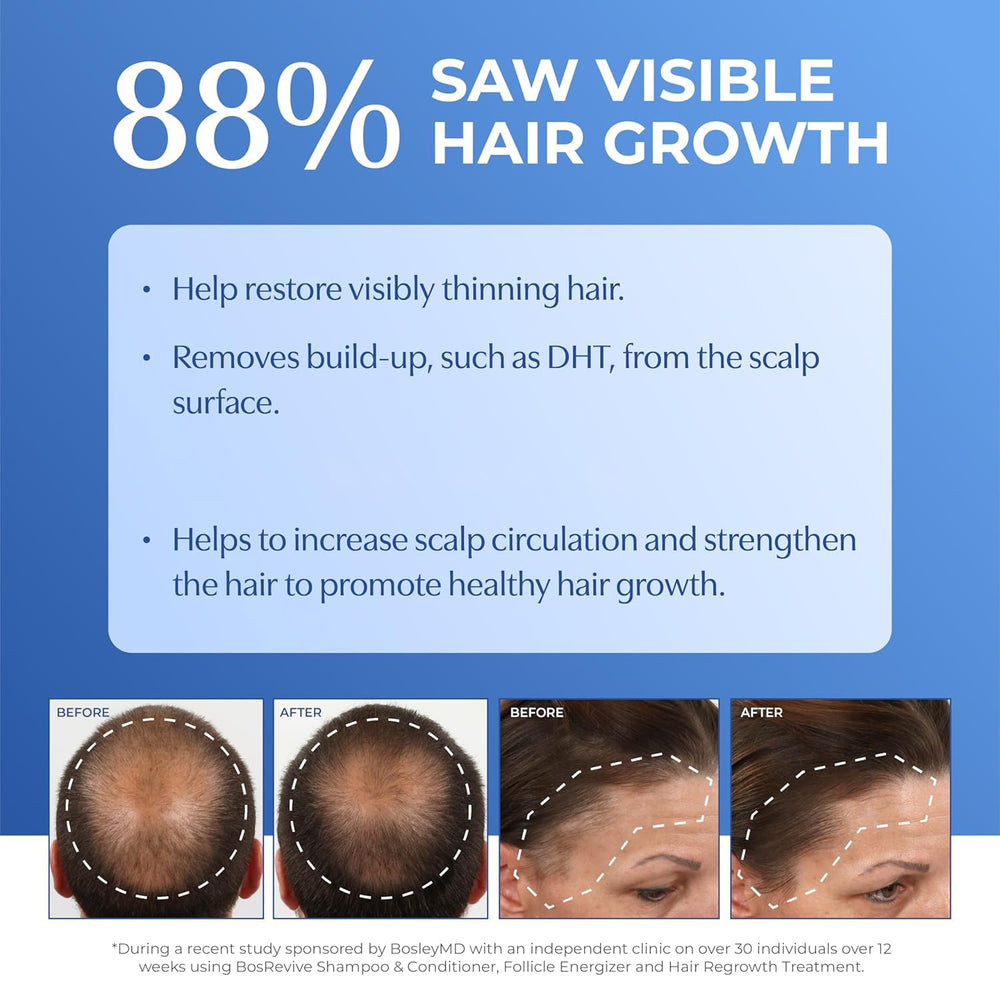 BosleyMD BosRevive Apple Stem Cell Extract graphic emphasizes scalp support.