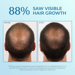 BosleyMD Minoxidil Foam scalp massage illustrating leave-in absorption.