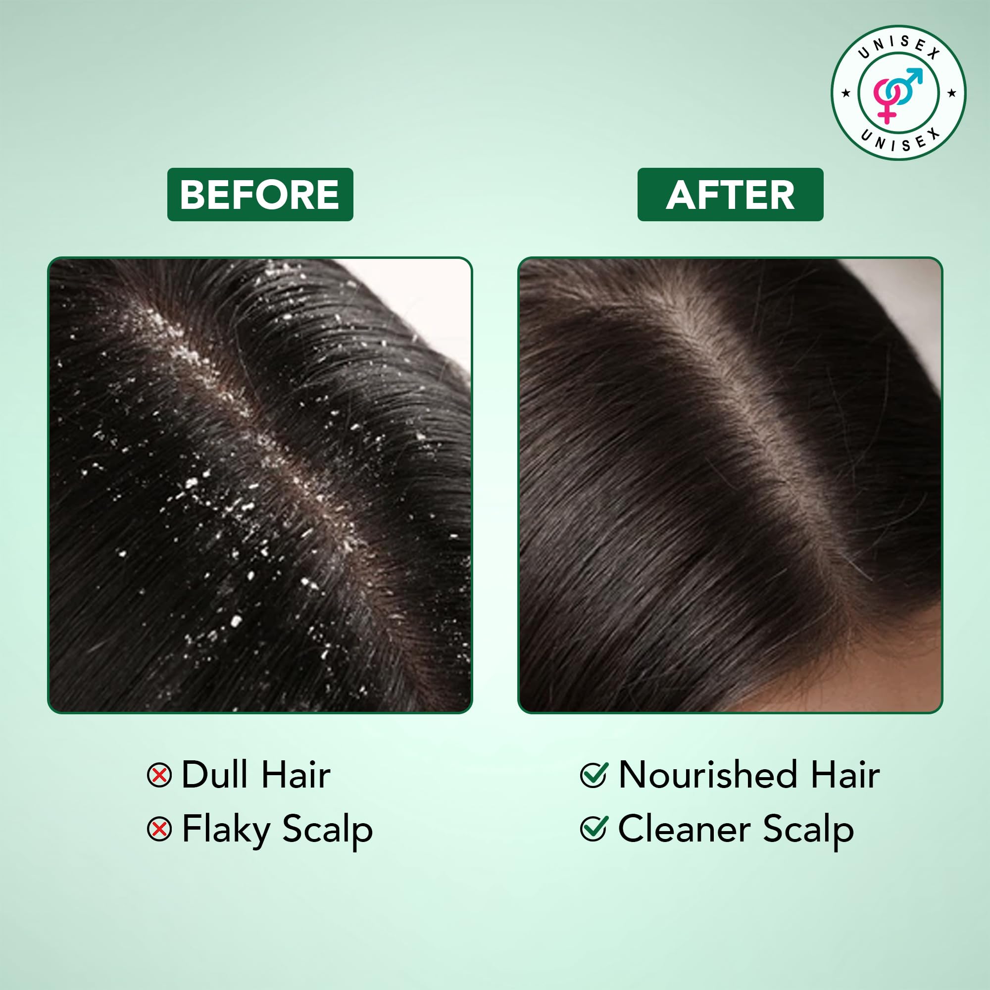 Botanic Hearth Tea Tree Shampoo foam showing rich lather.