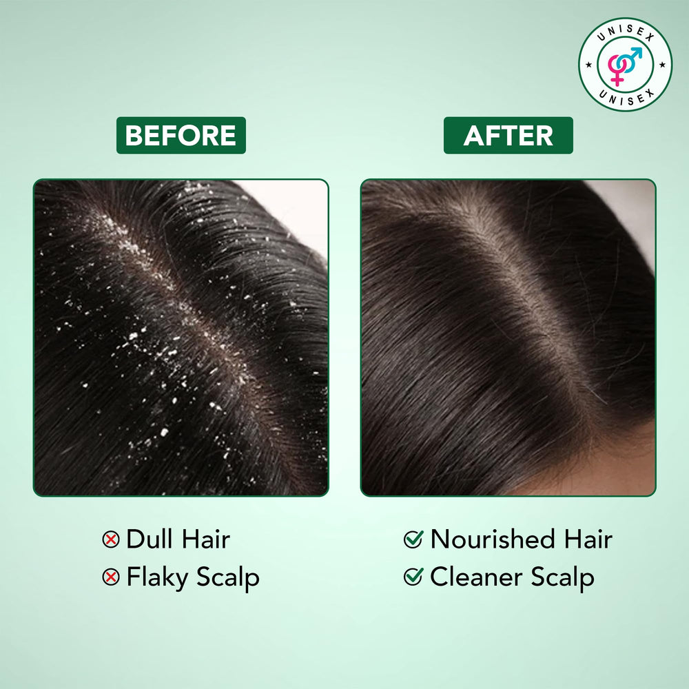 Botanic Hearth Tea Tree Shampoo foam showing rich lather.