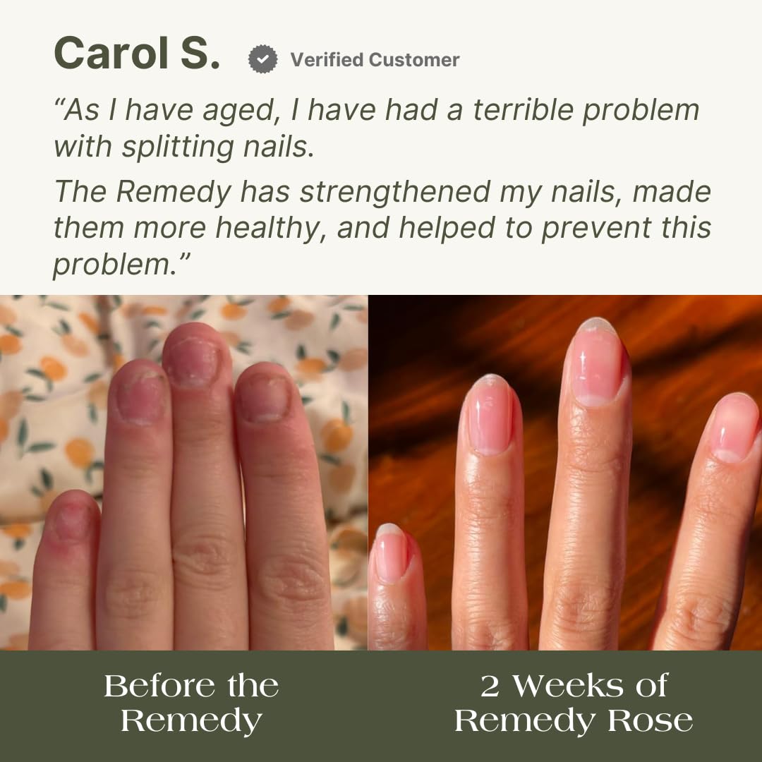 Botanist Nails The Remedy 21-free formula emphasizes vegan, non-toxic nail care.