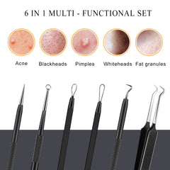 Boxoyx blackhead remover tools set neatly organized in a storage box for quick sessions