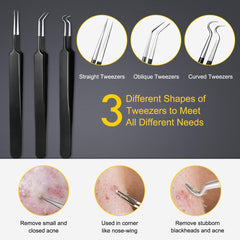 Boxoyx ergonomic non-slip handle enhances control during precise extractions