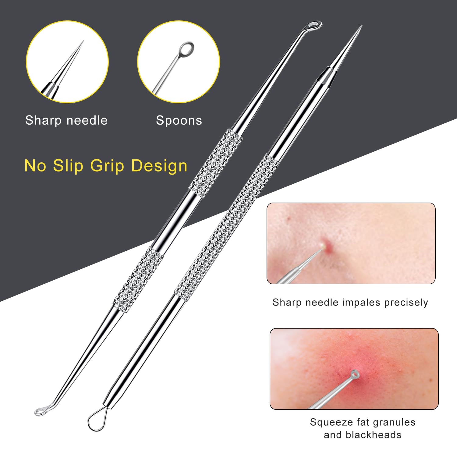 Boxoyx pimple popper tool kit for chin and forehead precision.